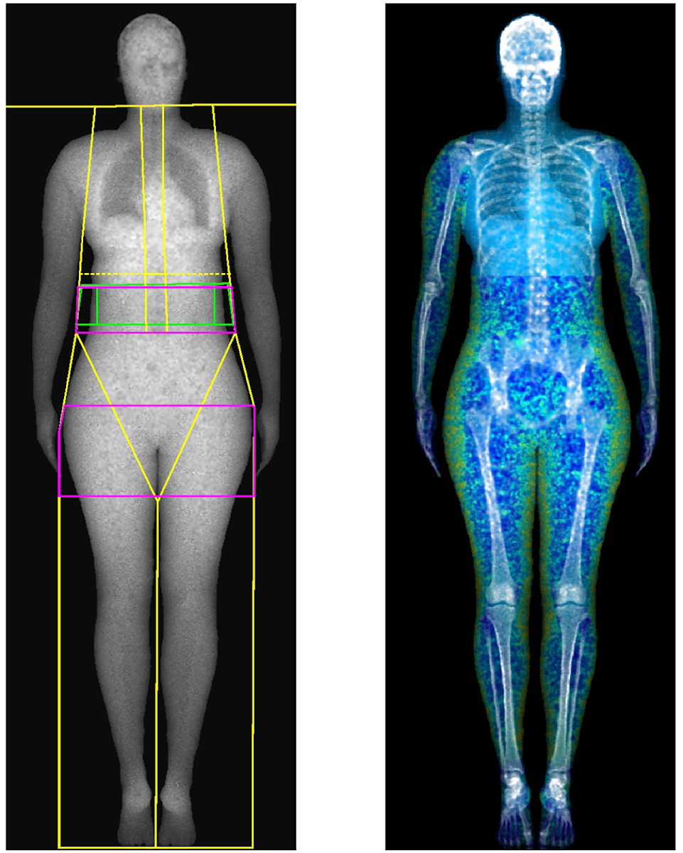 Photo via Google Maps · Dexa Scan