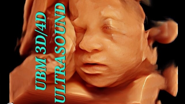 Photo via Google Maps · UBM 3D/4D Ultrasound Scans