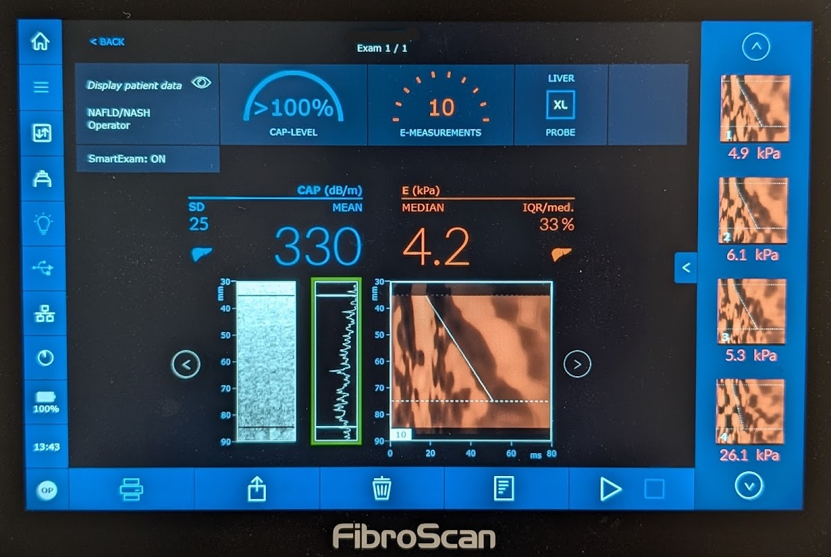 Photo via Google Maps · Liverscan - Western Sydney Liver Fibroscan