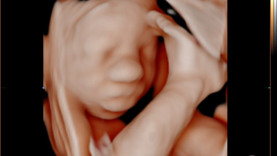 Photo via Google Maps · Bub-Scan 3D/4D Ultrasound