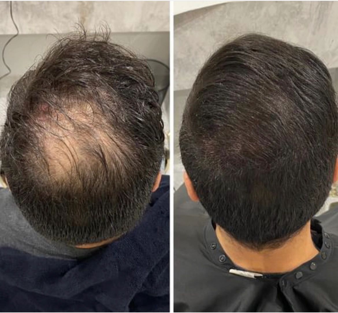 Photo via Google Maps · HairLoss Establishment