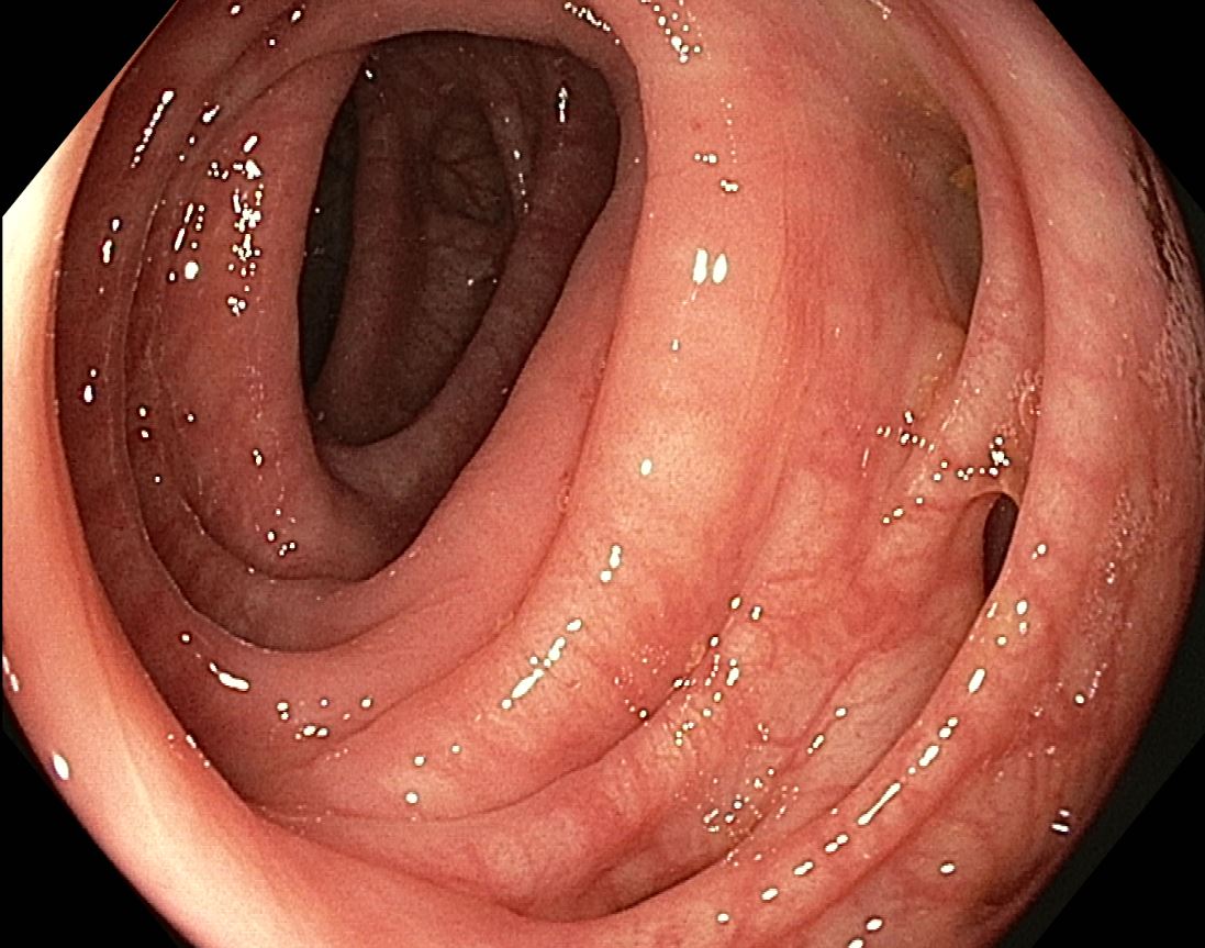 Gastroenterology Associates Miranda